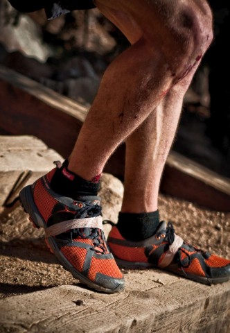 Given the steep grades, injuries are common on the Incline, particularly those that involve tripping on shoelaces.  Despite his laces being taped, this man's knee is dripping blood and his calf bears multiple cuts and scratches in testament to modest dangers of tackling the Manitou Springs Incline.